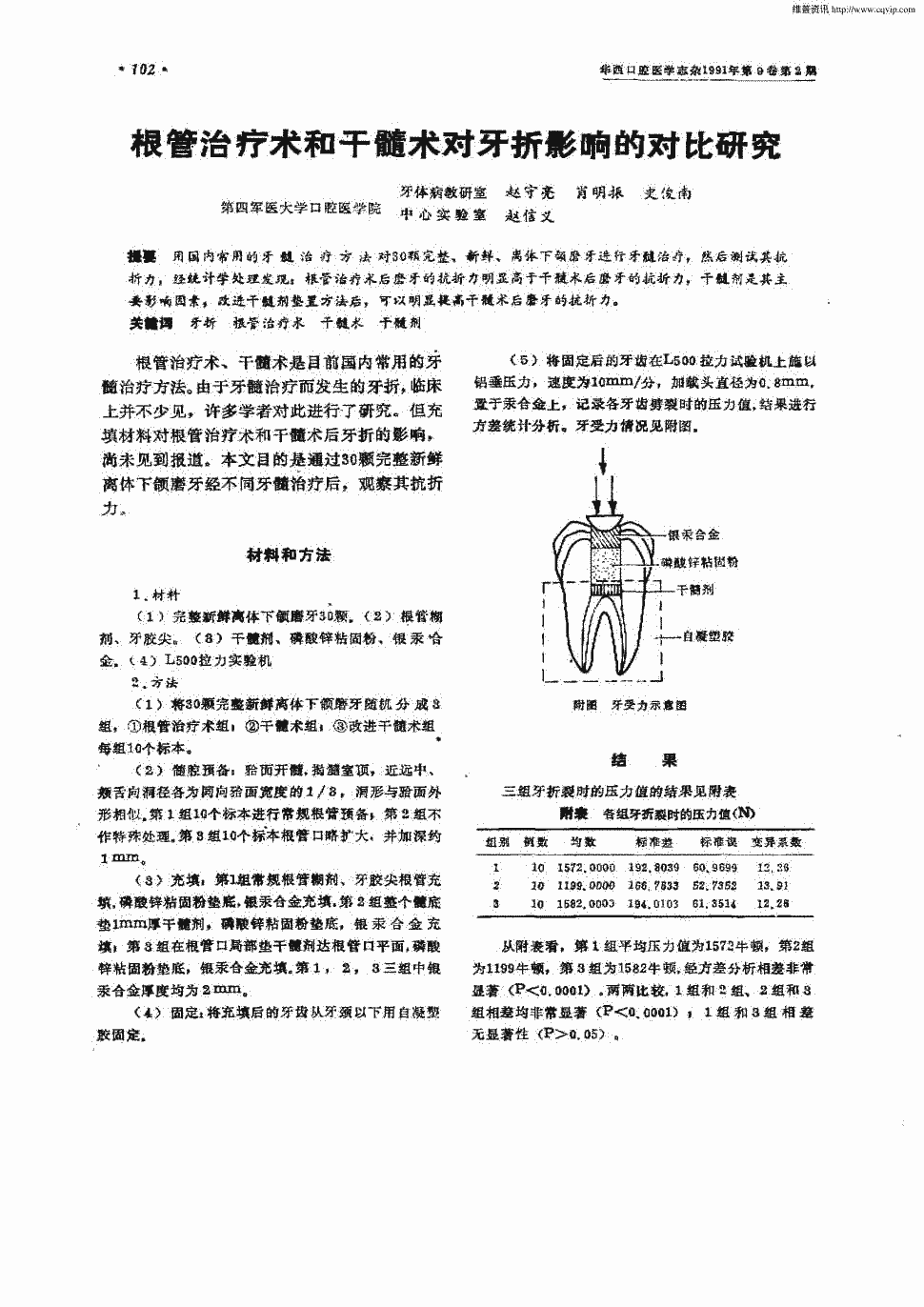 期刊根管治疗术和干髓术对牙折影响的对比研究被引量:13      用国内