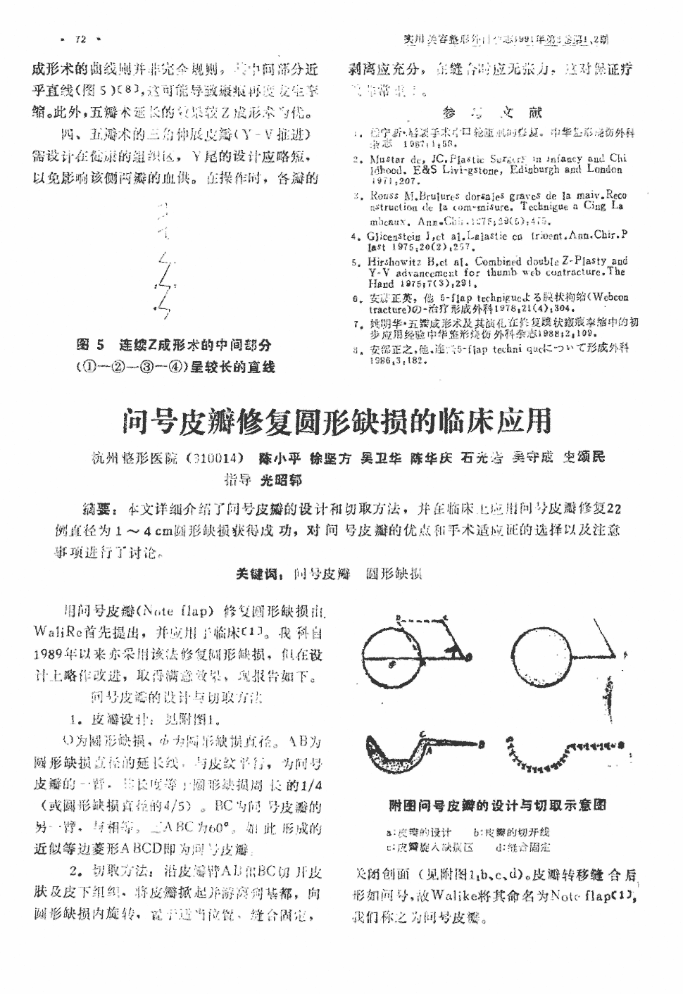 期刊问号皮瓣修复圆形缺损的临床应用被引量:1