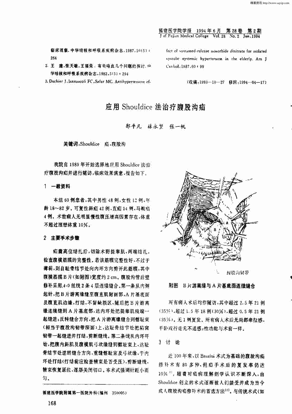 期刊应用shouldice法治疗腹股沟疝