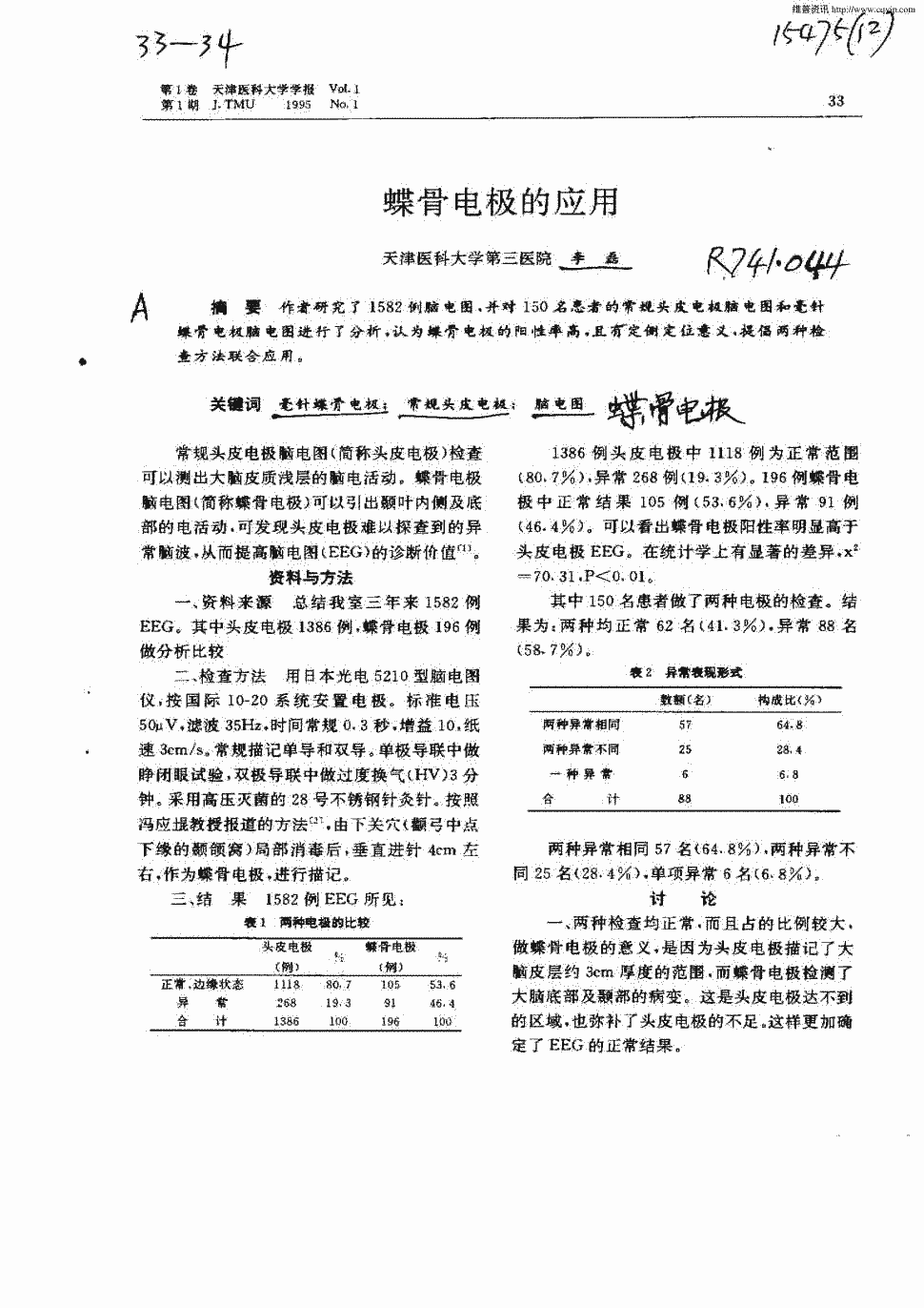 并对150名患者的常规头皮电极脑电图和毫针蝶骨电极脑电图进行了分析