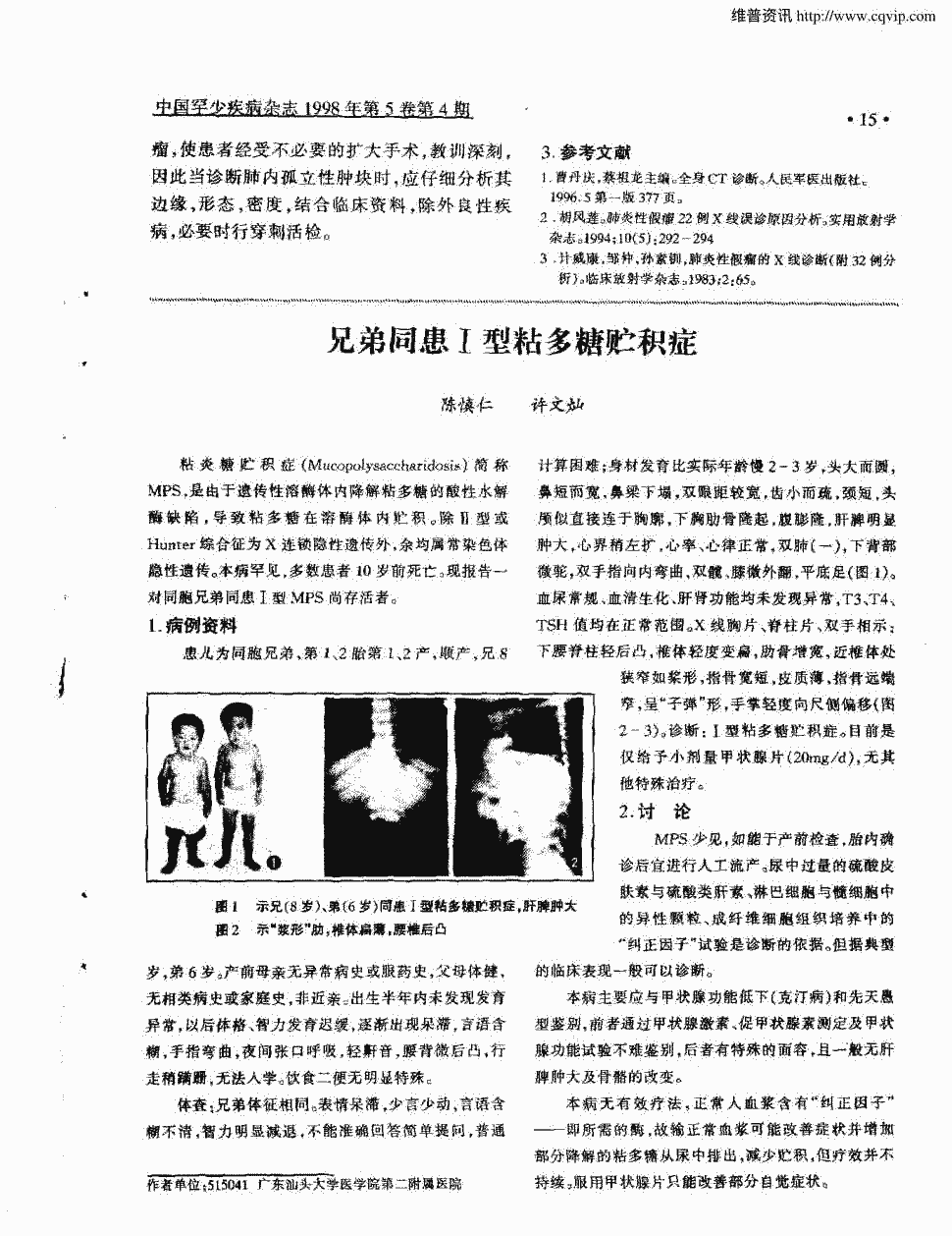 期刊兄弟同患Ⅰ型粘多糖贮积症    粘炎糖贮积症(mucopolysacchandos