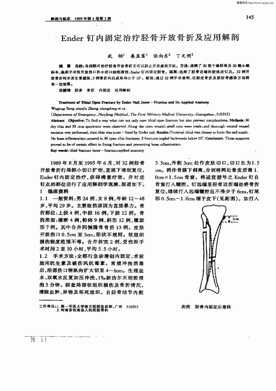 期刊ender钉内固定治疗胫骨开放骨折及应用解剖      目的:寻找既可