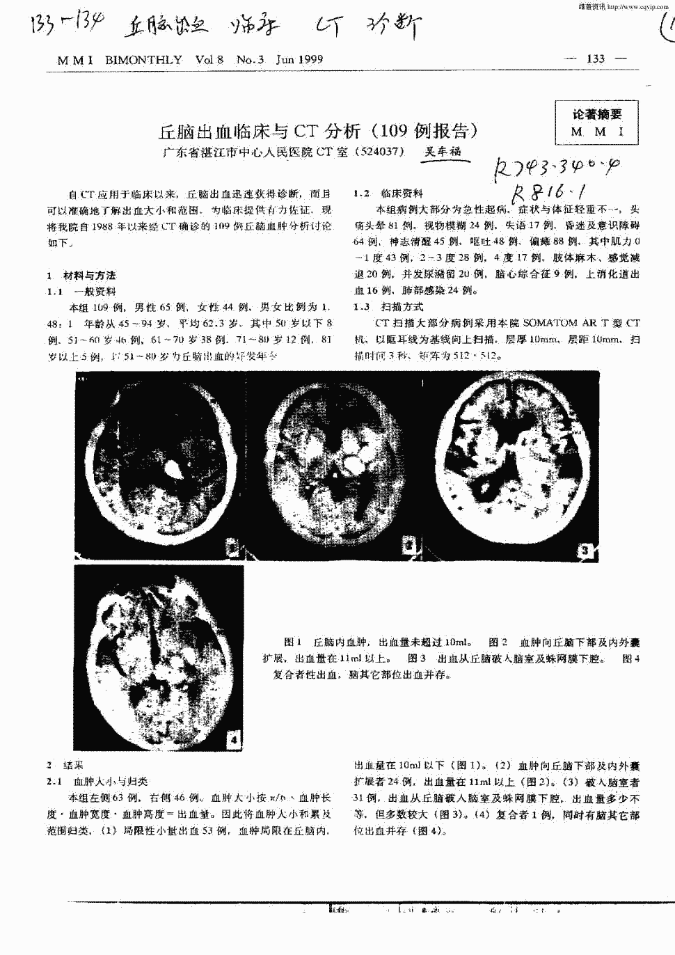 1999年第3期 133-134,共2页吴车福关键词:丘脑出血临床ct诊断