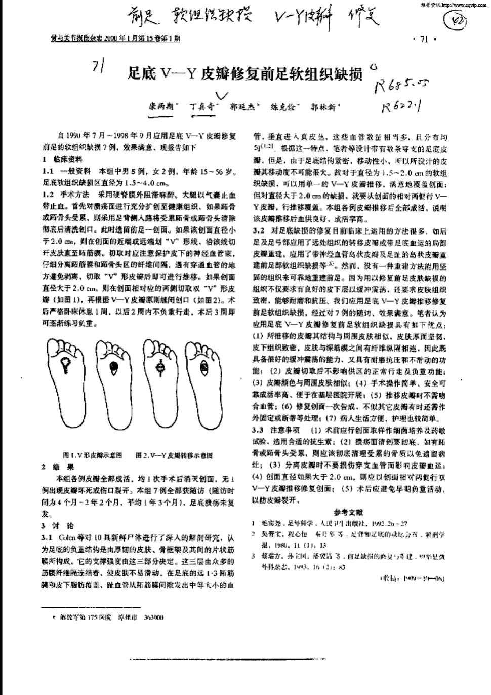 期刊足底v—y皮瓣修复前足软组织缺损被引量:1