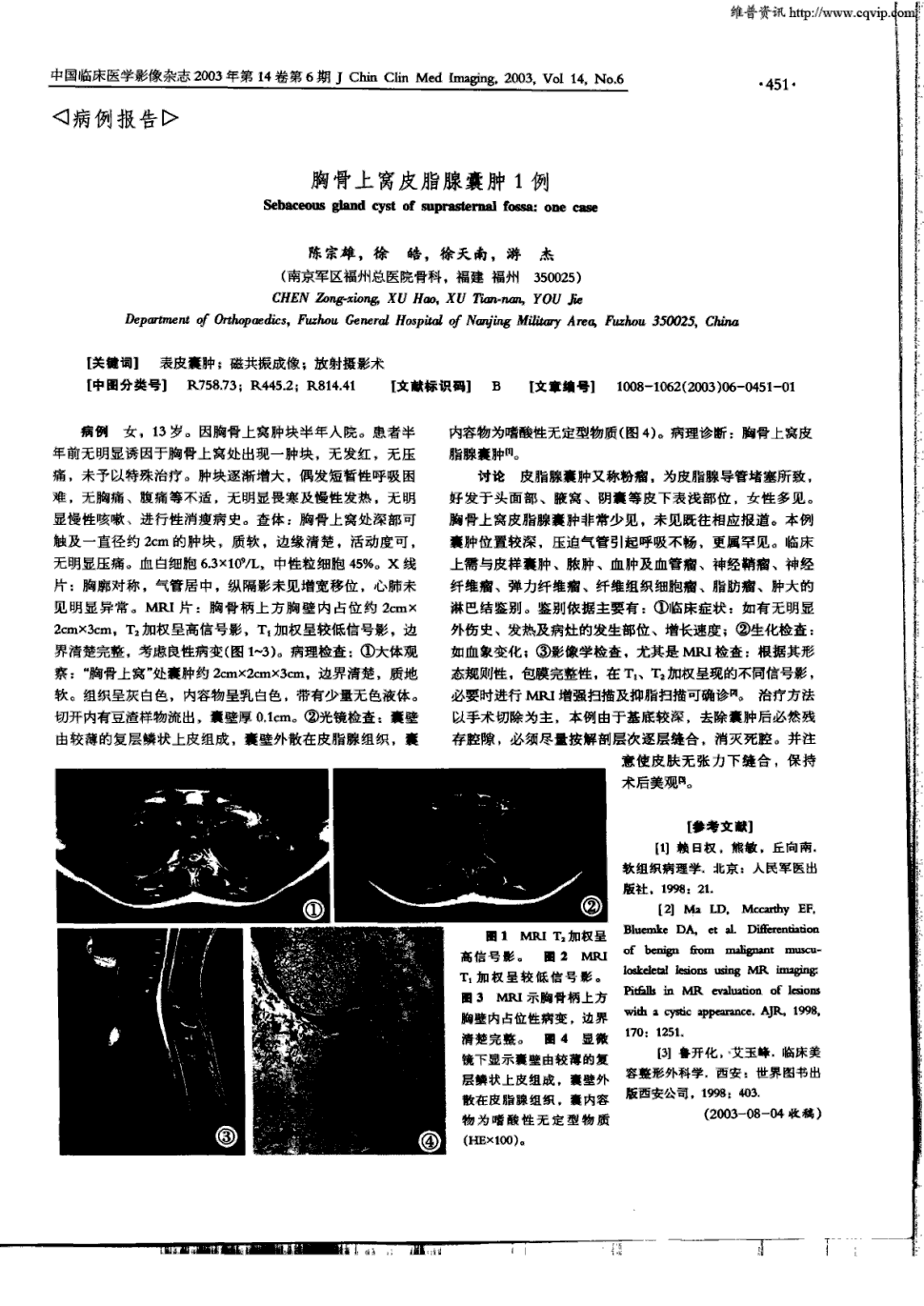 因胸骨上窝肿块半年入院.