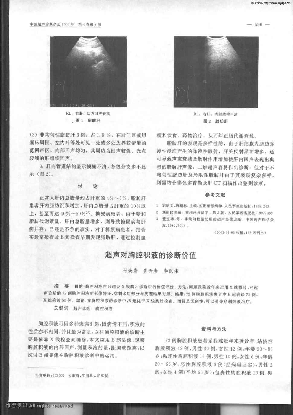 结论:在胸腔积液的诊断中,b超优于x.显示全部