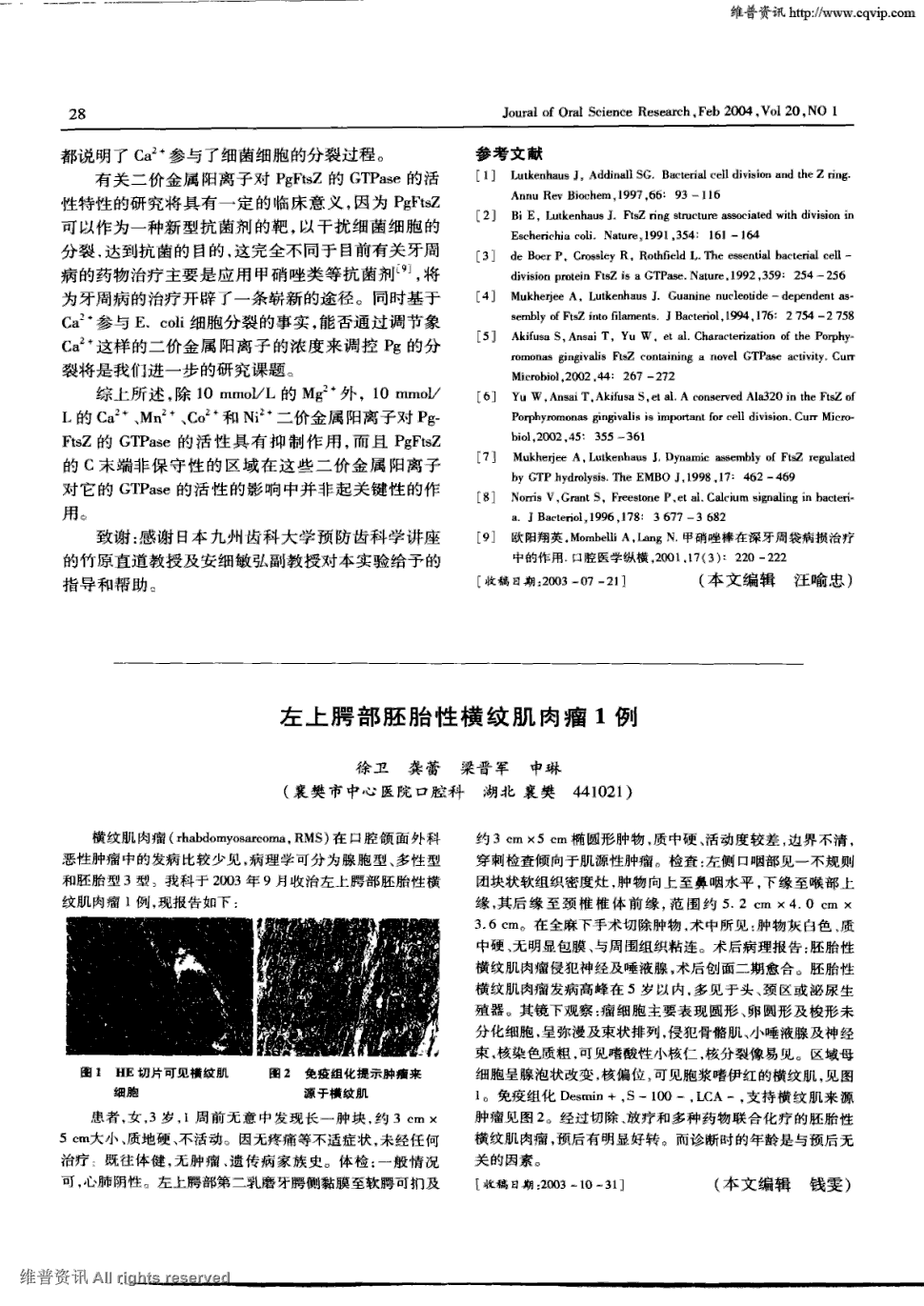 期刊左上腭部胚胎性横纹肌肉瘤1例被引量:1      横纹既肉瘤