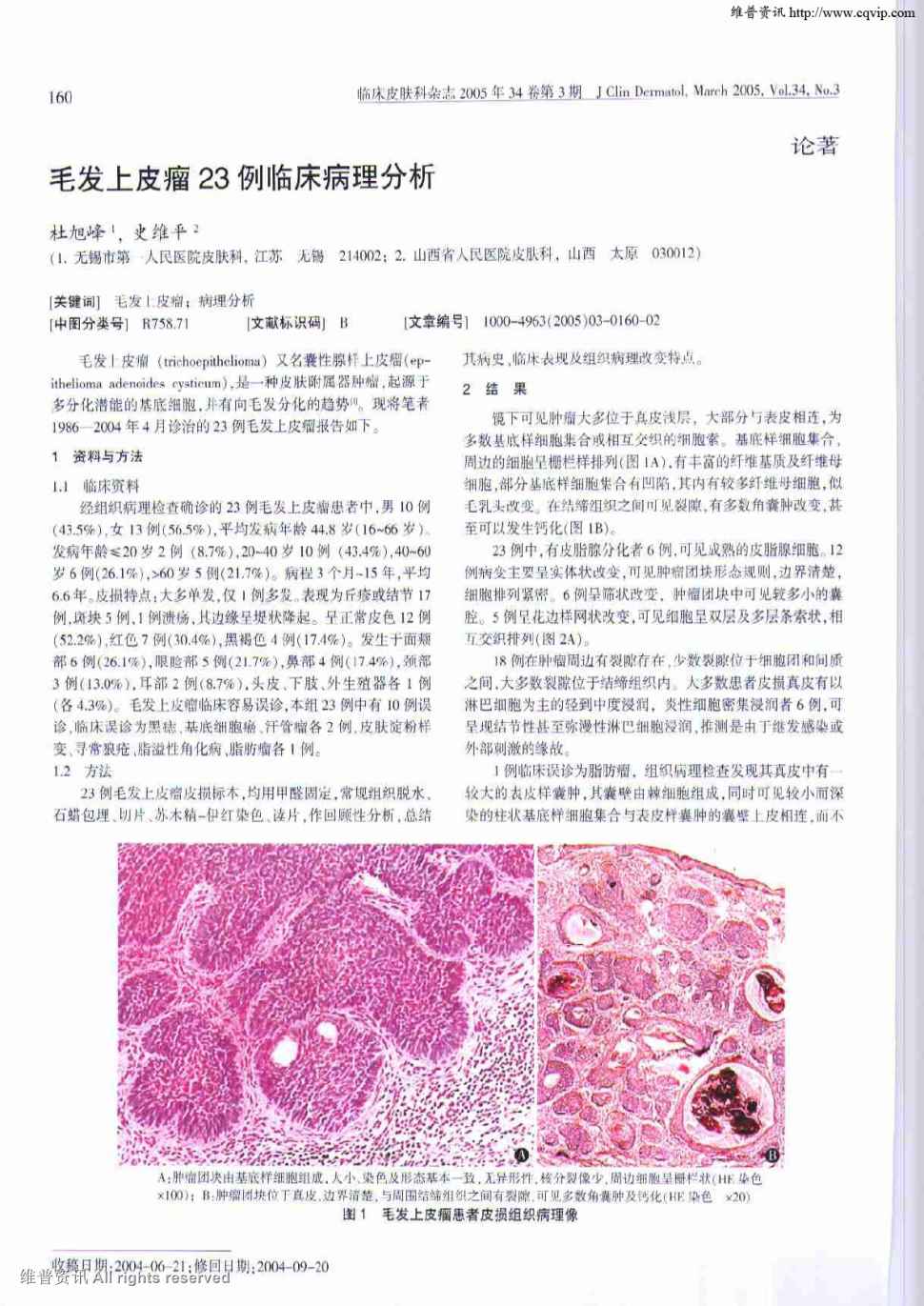 期刊毛发上皮瘤23例临床病理分析被引量:4    毛发上皮瘤(tricho