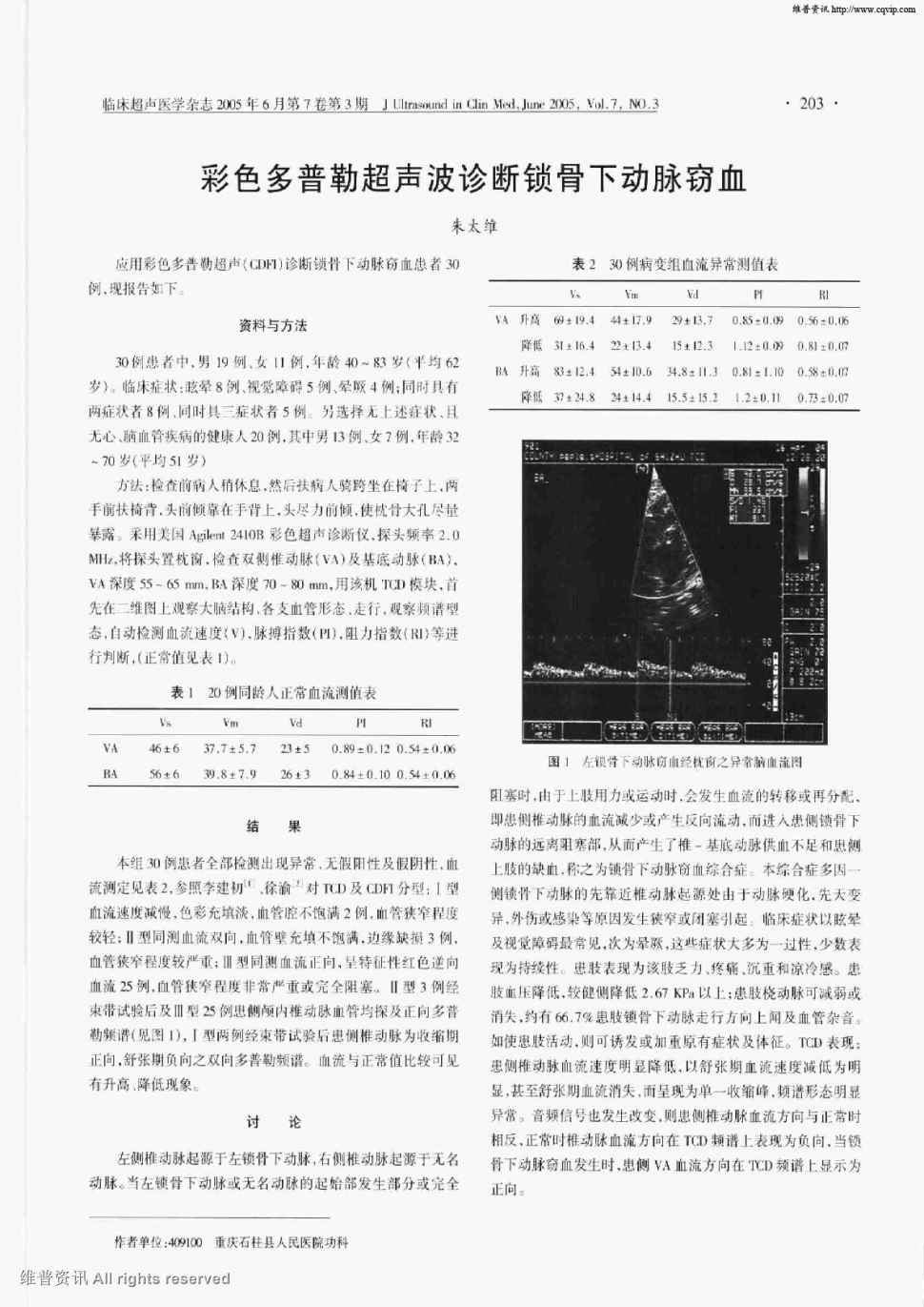 期刊彩色多普勒超声波诊断锁骨下动脉窃血被引量:4