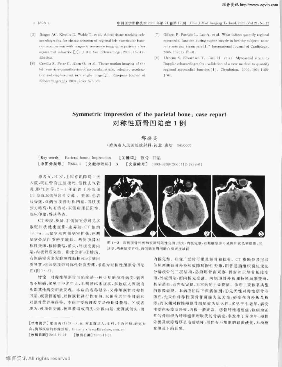 查体:患者浅昏迷,双侧颅顶骨对称凹陷,四肢肌张力略高,均有活动,双侧