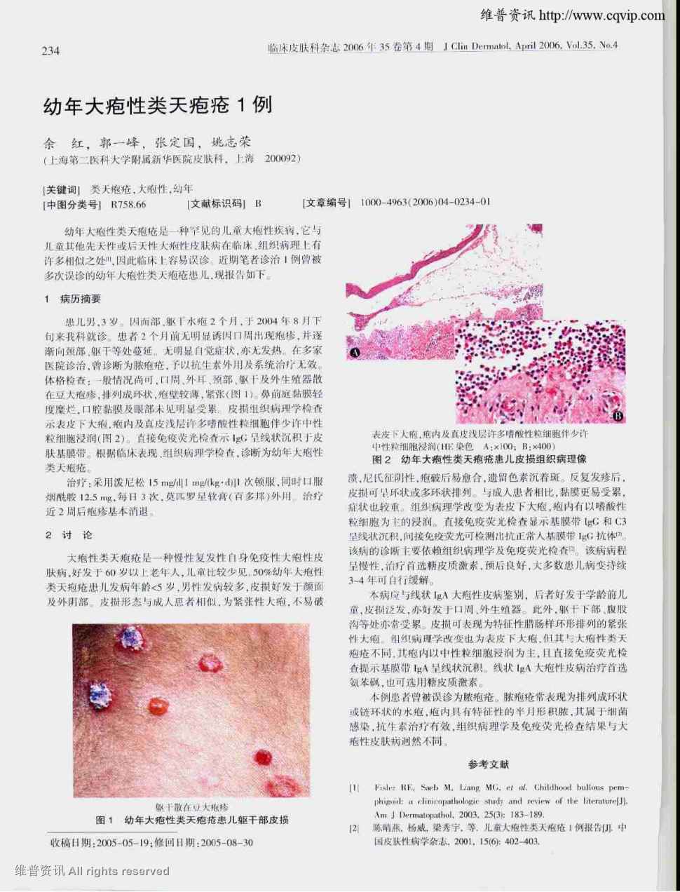 见的儿童大疱性疾病,它与儿童其他先天性或后天性大疱性皮肤病在临床