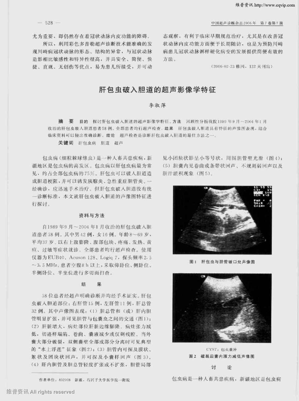 期刊肝包虫破入胆道的超声影像学特征被引量:6   目的 探讨肝包虫破