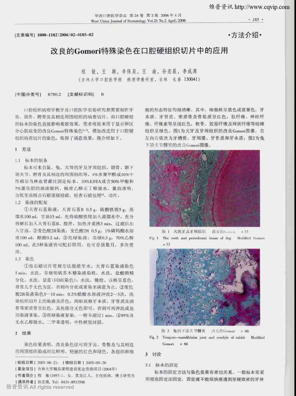 期刊改良gomori特殊染色在口腔硬组织切片中的应用被引量:16