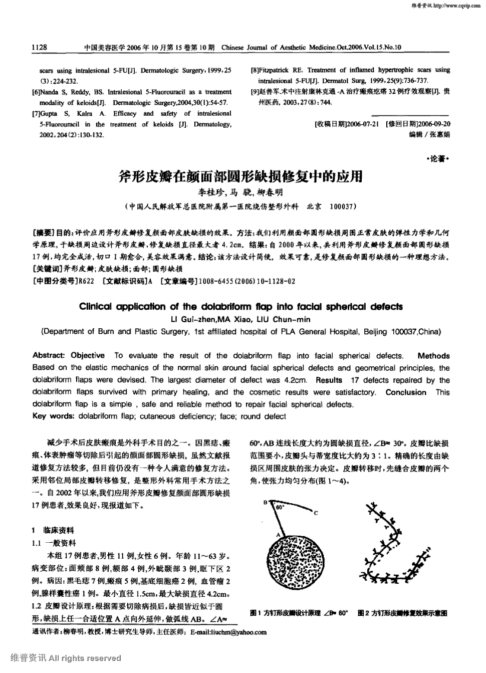 期刊斧形皮瓣在颜面部圆形缺损修复中的应用被引量:13     目的:评价