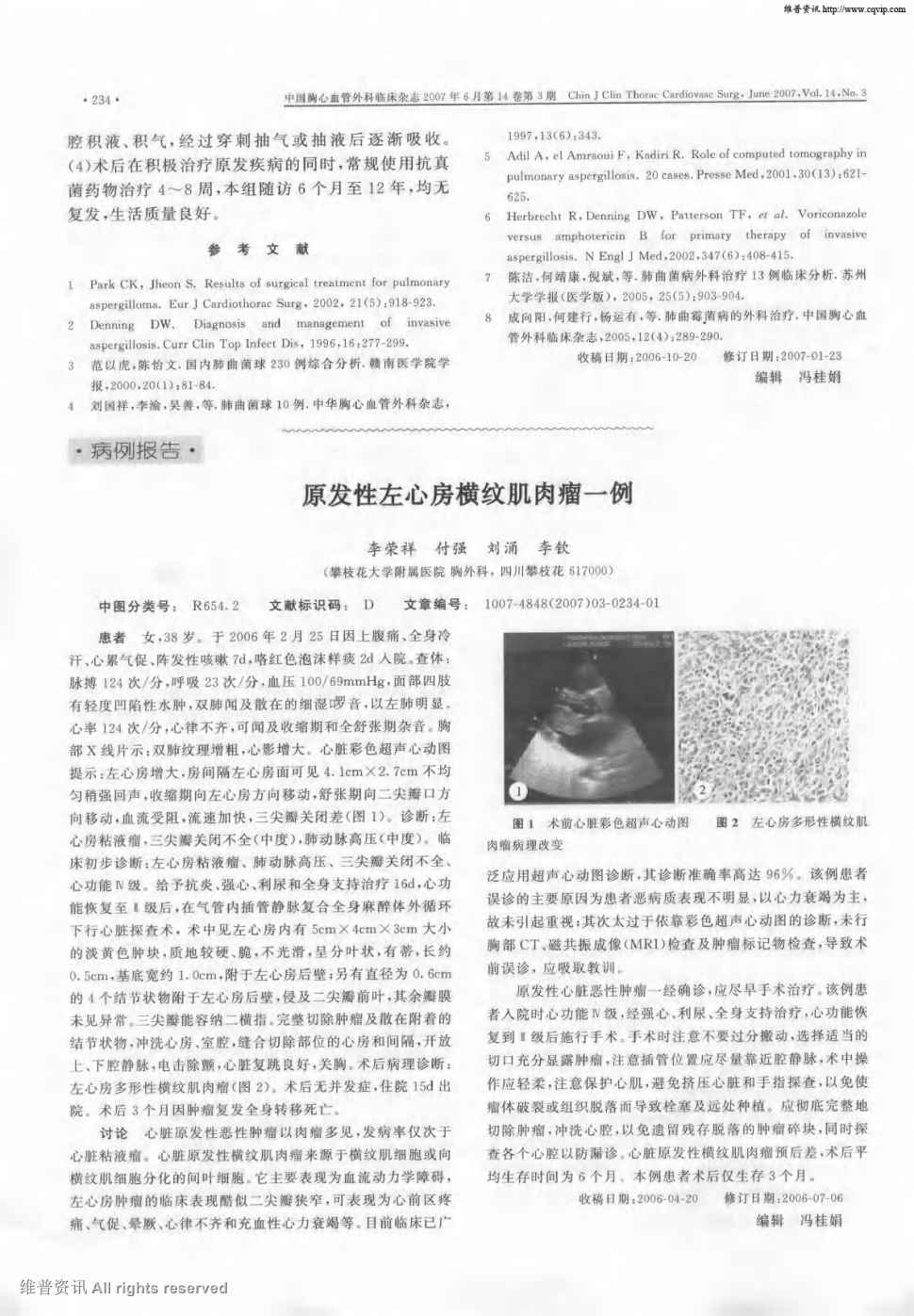 期刊原发性左心房横纹肌肉瘤一例      患者女,38岁.