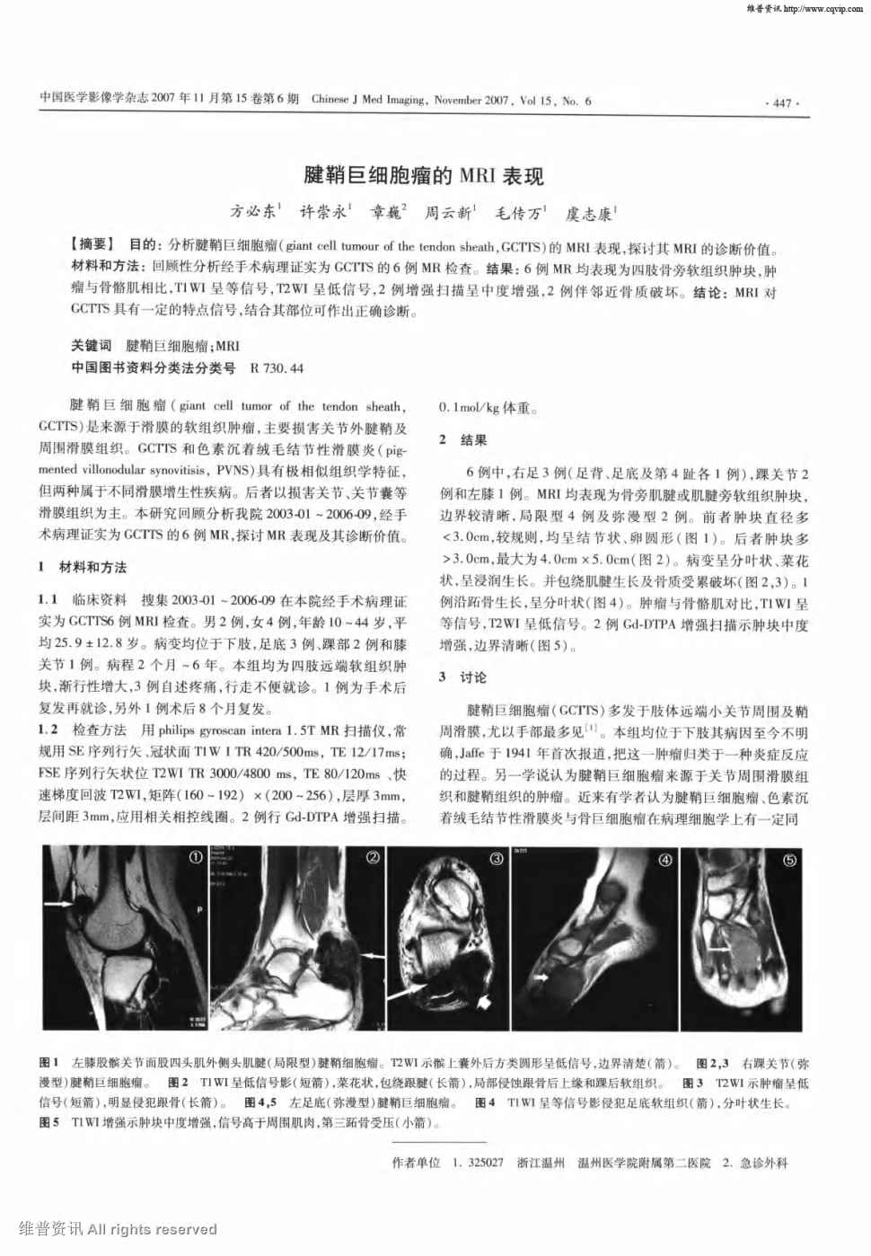 期刊腱鞘巨细胞瘤的mri表现被引量:10        目的:分析腱鞘巨细胞瘤