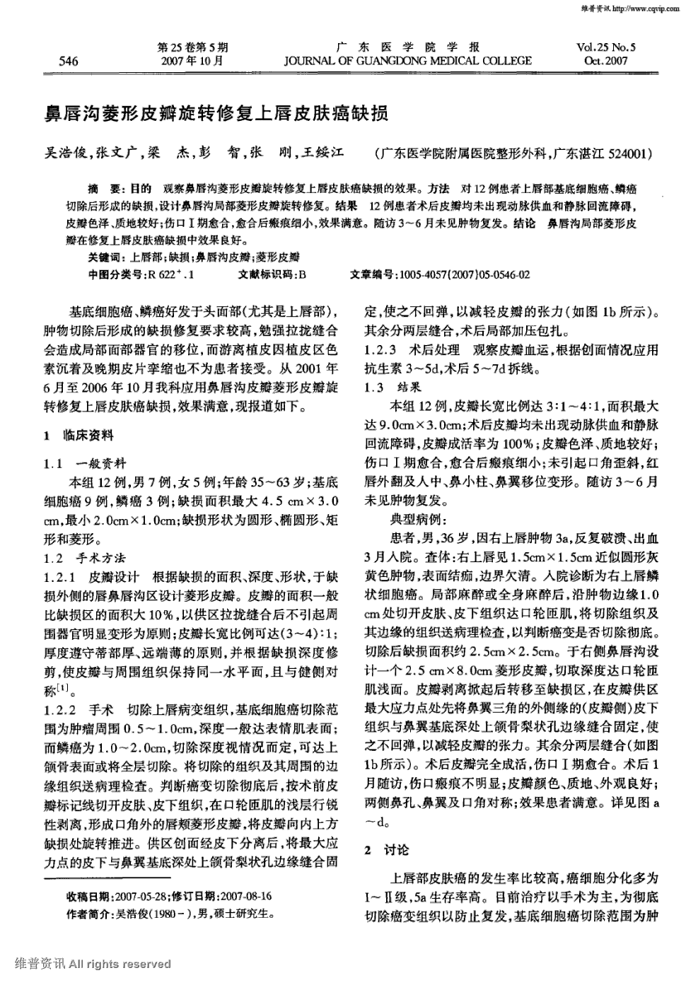 鳞癌切除后形成的缺损,设计鼻唇沟局部菱形皮瓣旋转修复