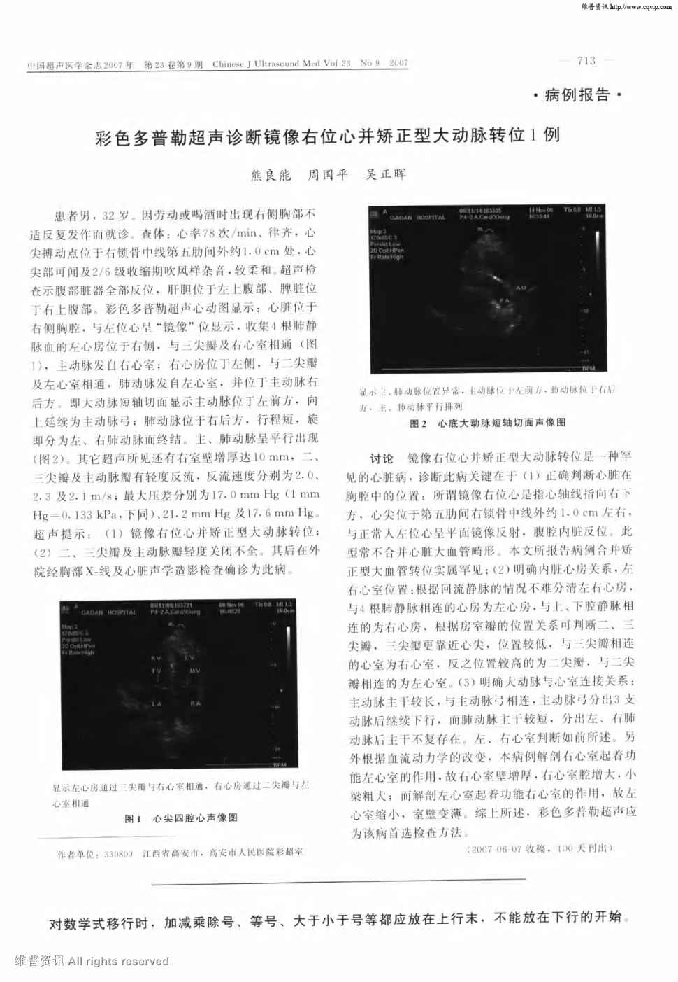 期刊彩色多普勒超声诊断镜像右位心并矫正型大动脉转位1例     患者