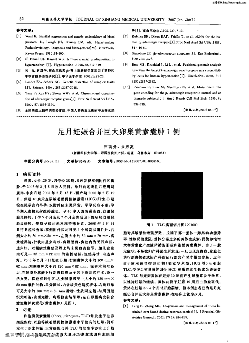 期刊足月妊娠合并巨大卵巢黄素囊肿1例    1病历资料  患者,女性,29