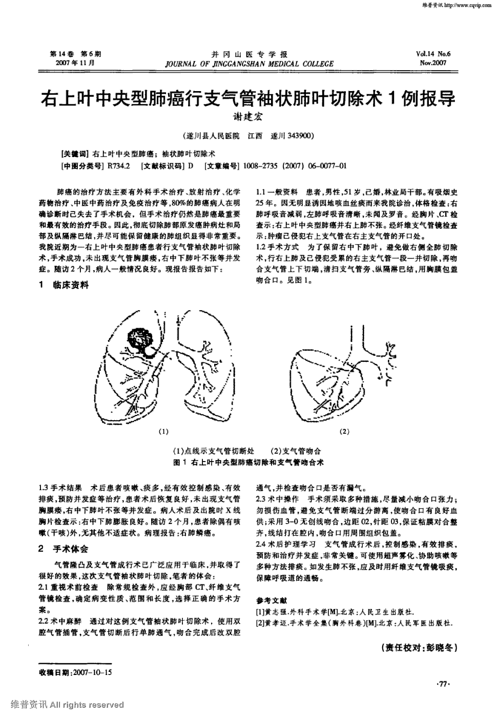 期刊右上叶中央型肺癌行支气管袖状肺叶切除术1例报导   肺癌的治疗