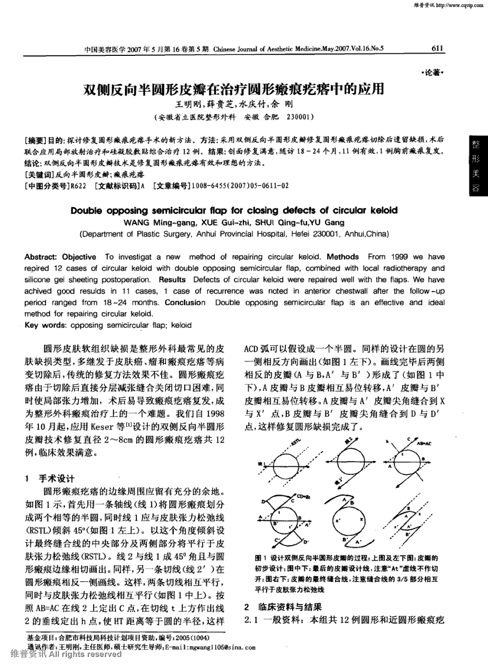 期刊双侧反向半圆形皮瓣在治疗圆形瘢痕疙瘩中的应用