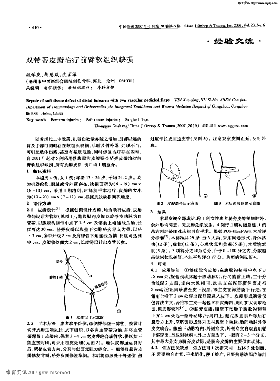 自2001年起对5例采用髂腹股沟皮瓣联合脐旁皮瓣治疗前臂软组织.