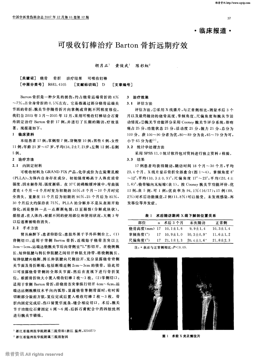 期刊可吸收钉棒治疗barton骨折远期疗效被引量:3     barton骨折是一