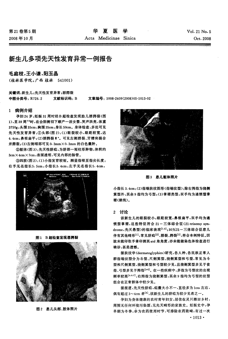 《华夏医学》2008年第5期 1013-1014,共2页毛庭枝王小谦