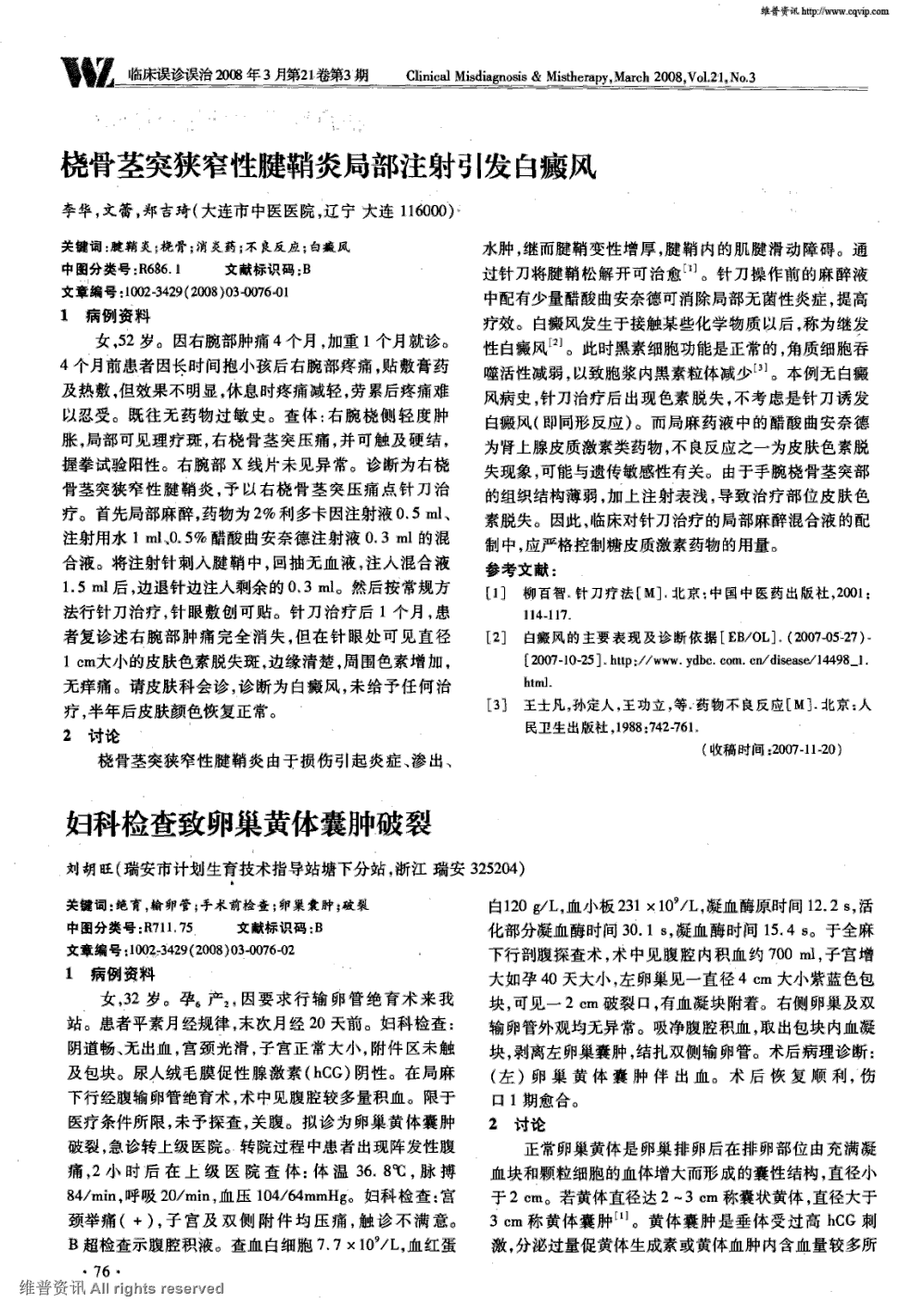 期刊桡骨茎突狭窄性腱鞘炎局部注射引发白癜风被引量:3     1病例