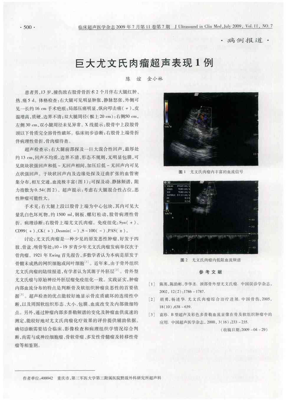 期刊巨大尤文氏肉瘤超声表现1例被引量:1    患者男,13岁,撞伤致右