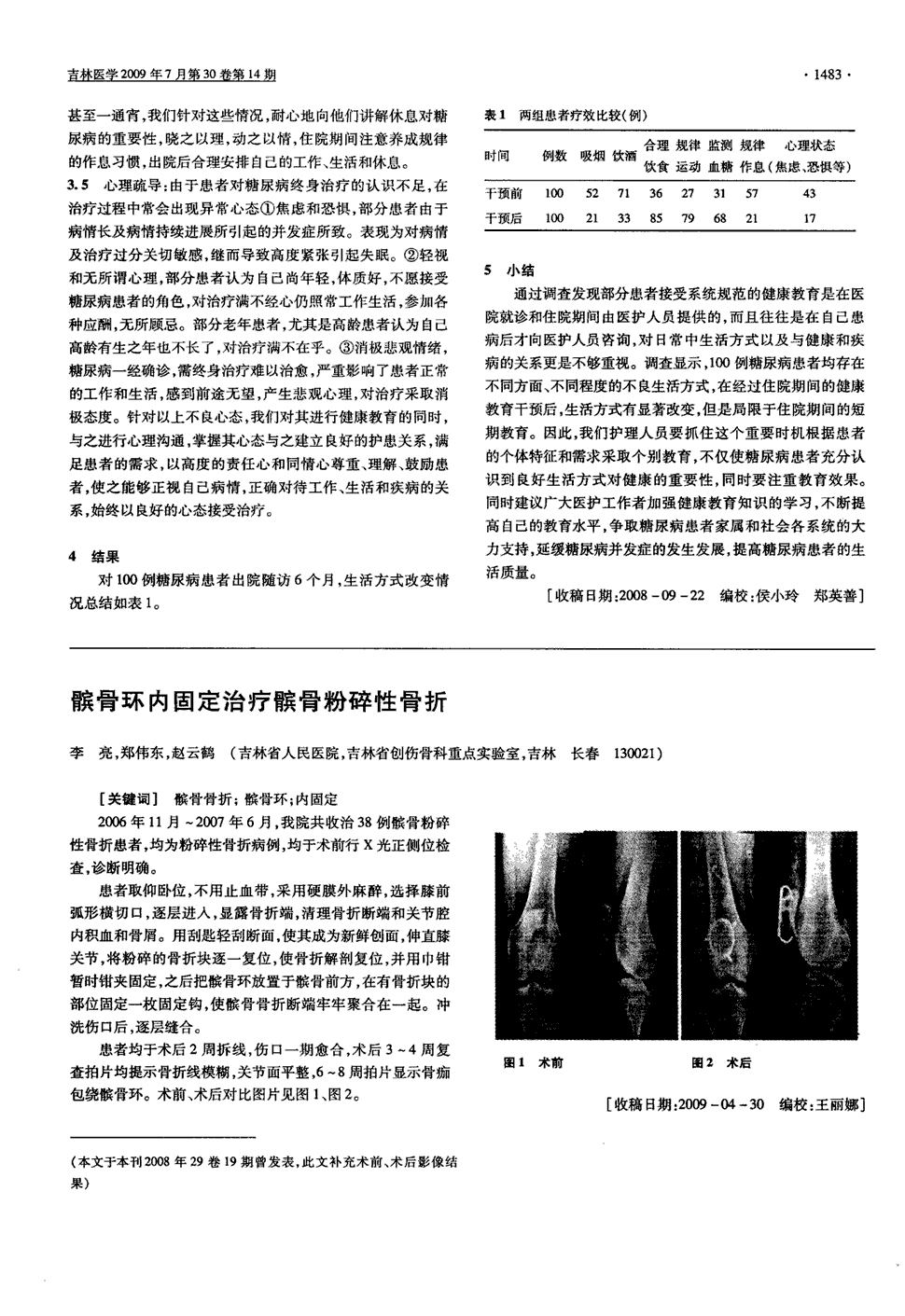 期刊髌骨环内固定治疗髌骨粉碎性骨折被引量:4     2006年11月～2007
