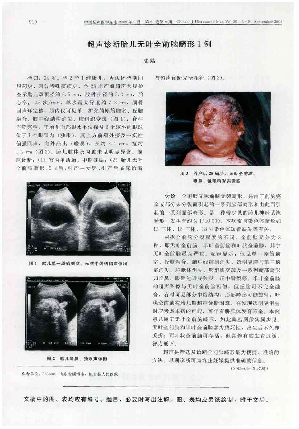期刊超声诊断胎儿无叶全前脑畸形1例   孕妇,34岁.