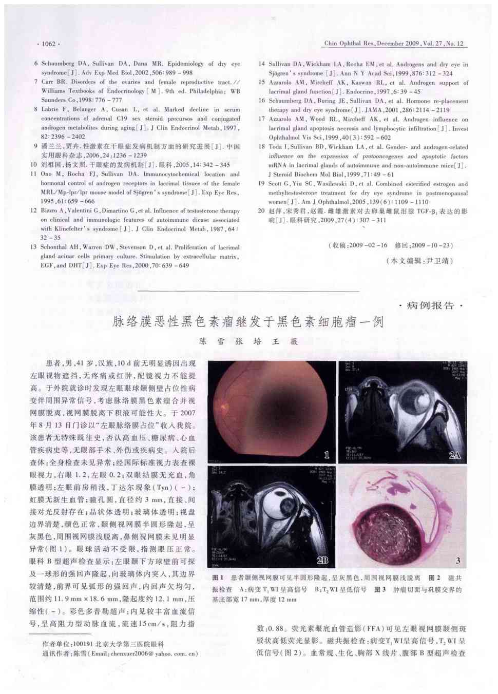 期刊脉络膜恶性黑色素瘤继发于黑色素细胞瘤一例被引量:1     患者,男