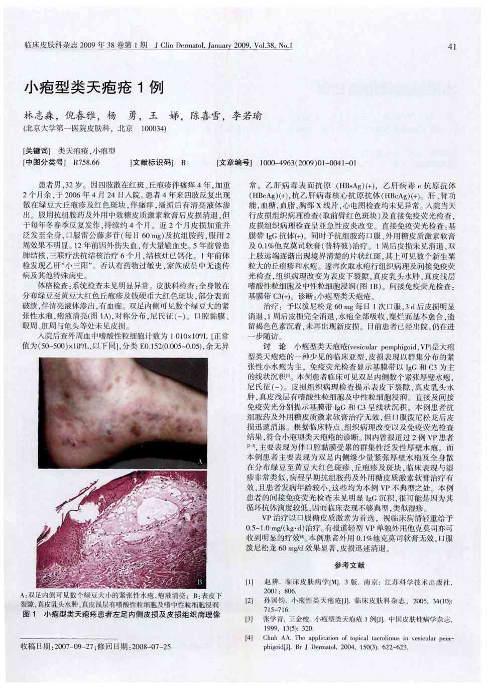 患者4年来四肢反复出现散在绿豆大丘疱疹及红色斑块,伴瘙痒,搔抓后有