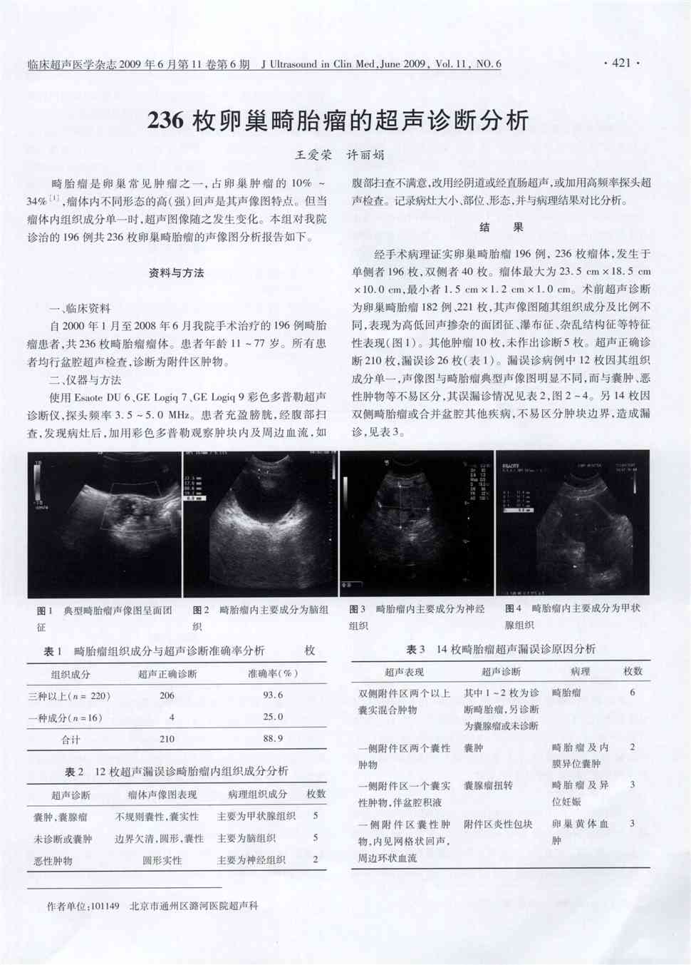 期刊236枚卵巢畸胎瘤的超声诊断分析被引量:5    畸胎瘤是卵巢常见