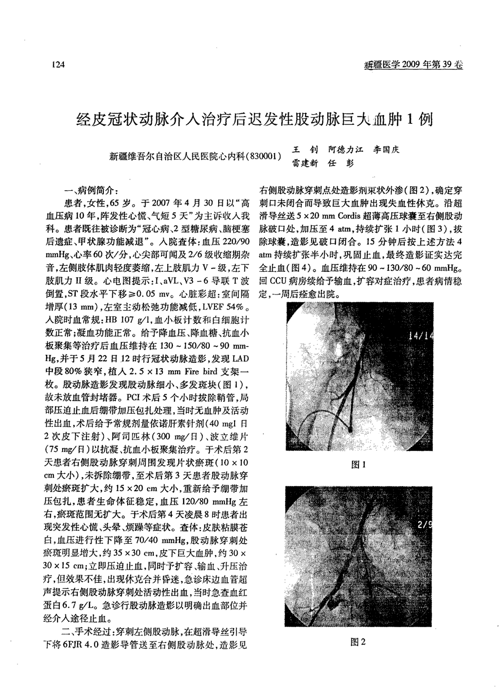 期刊经皮冠状动脉介入治疗后迟发性股动脉巨大血肿1例       一,病例