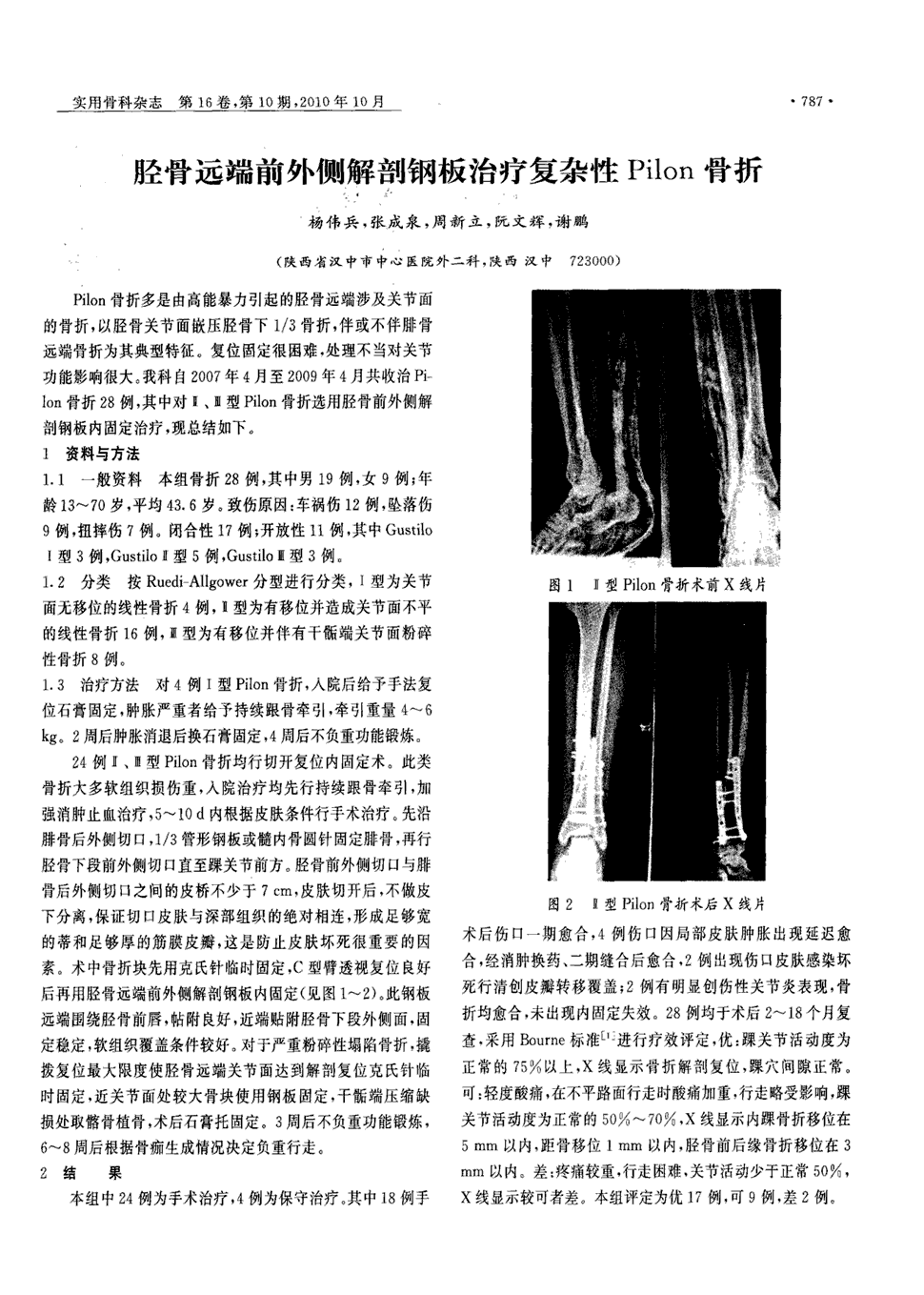 期刊胫骨远端前外侧解剖钢板治疗复杂性pilon骨折被引量:2