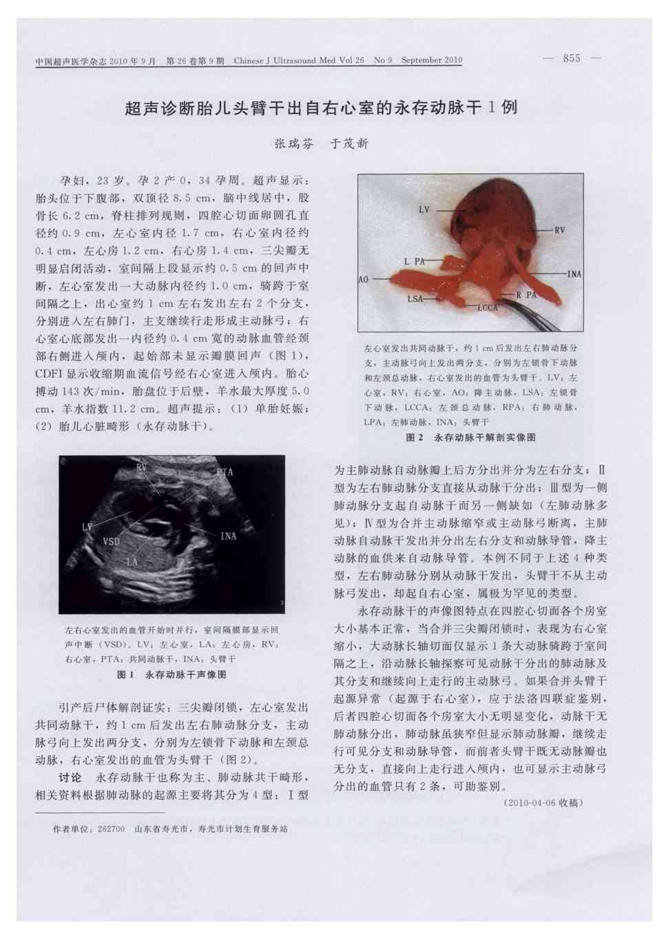 期刊超声诊断胎儿头臂干出自右心室的永存动脉干1例    孕妇,23岁.
