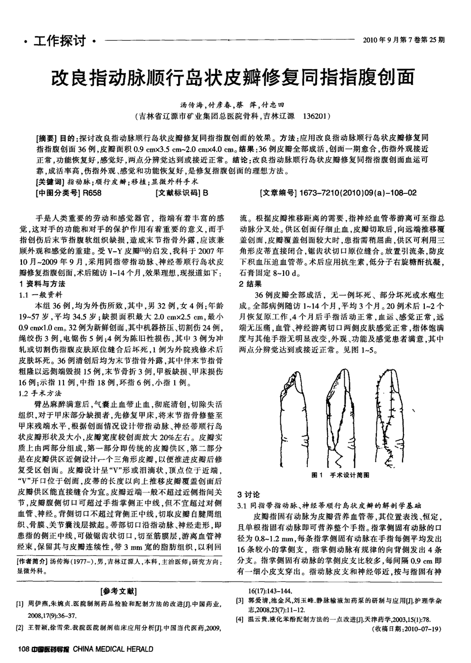 期刊改良指动脉顺行岛状皮瓣修复同指指腹创面被引量:9      目的