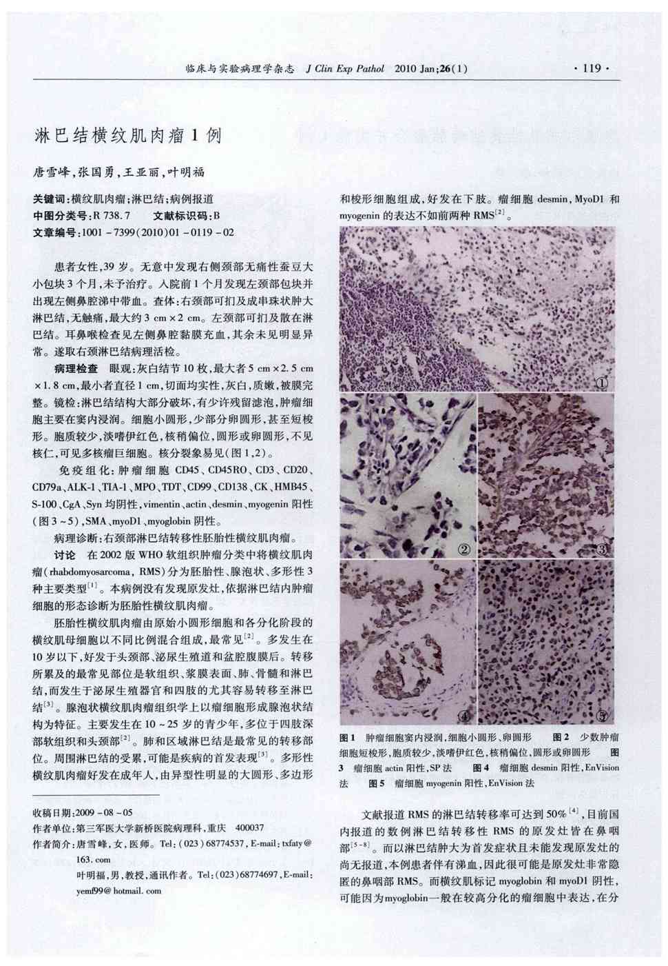 期刊淋巴结横纹肌肉瘤1例被引量:1      患者女性,39岁.