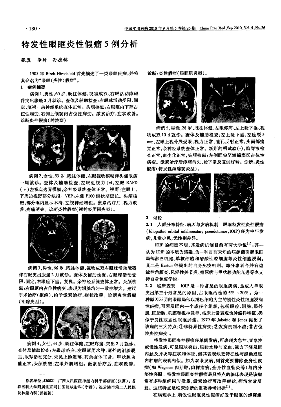 期刊特发性眼眶炎性假瘤5例分析被引量:3     1905年birch