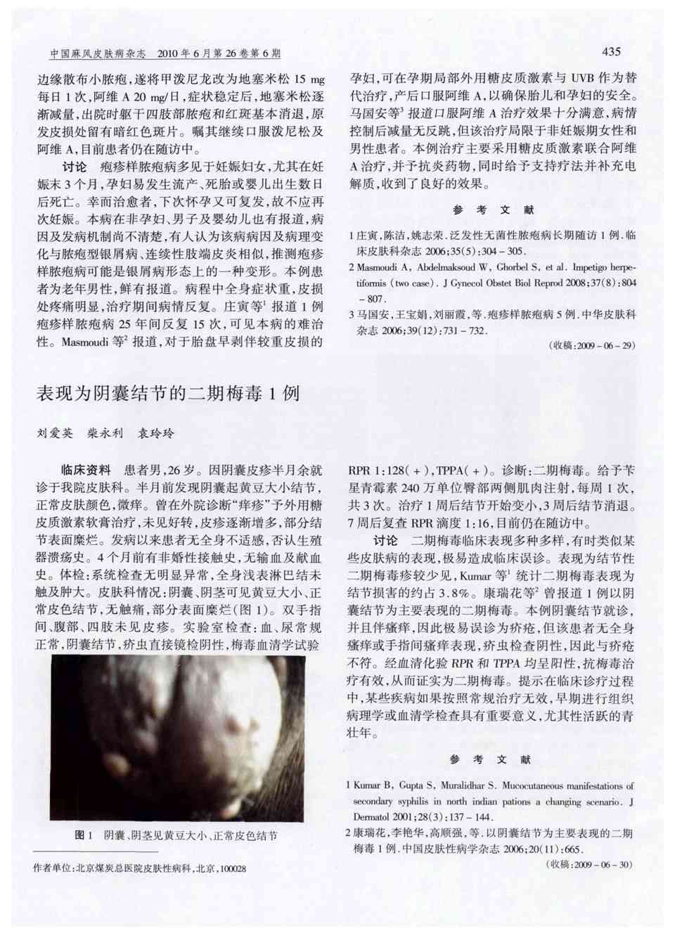 期刊表现为阴囊结节的二期梅毒1例     临床资料患者男,26岁.