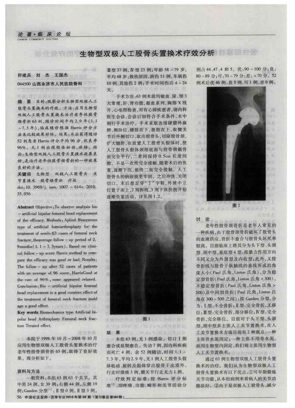 期刊生物型双极人工股骨头置换术疗效分析被引量:2     目的:观察