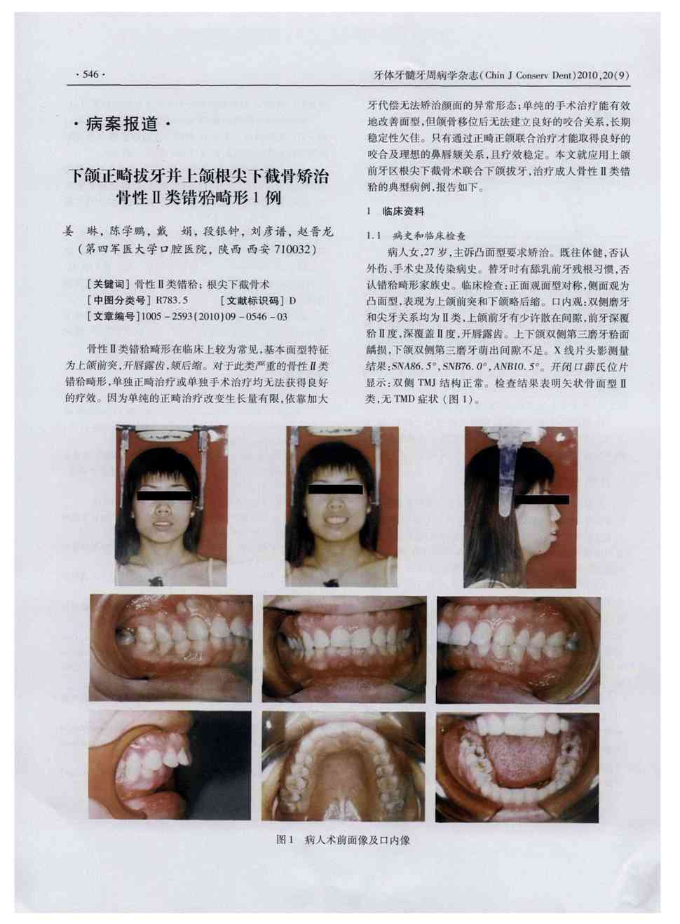 《牙体牙髓牙周病学杂志》2010年第9期546-548,共3页姜琳陈学鹏戴娟段