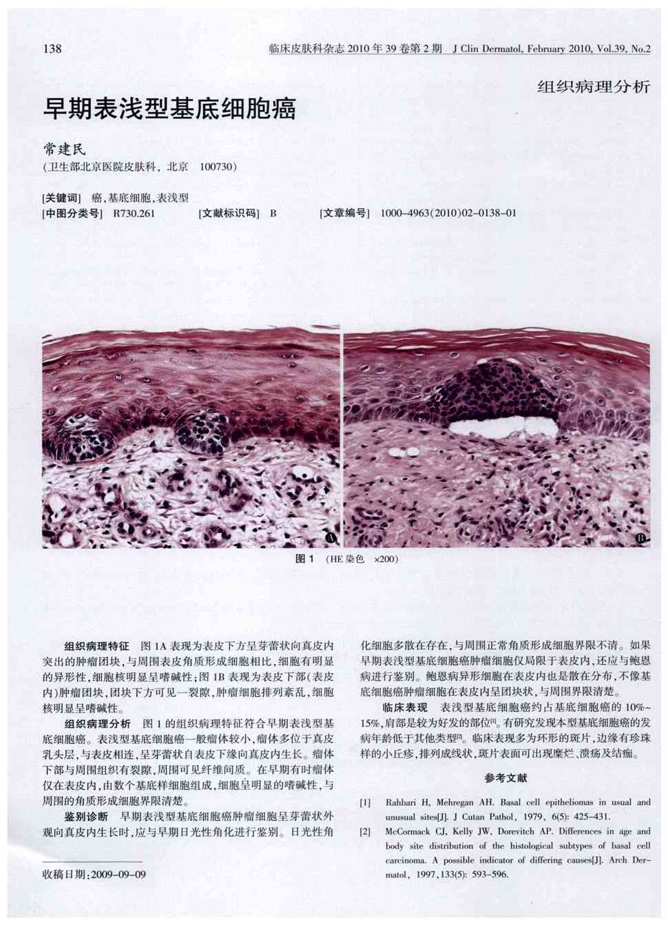 期刊早期表浅型基底细胞癌被引量:3   组织病理特征图1a表现为表皮