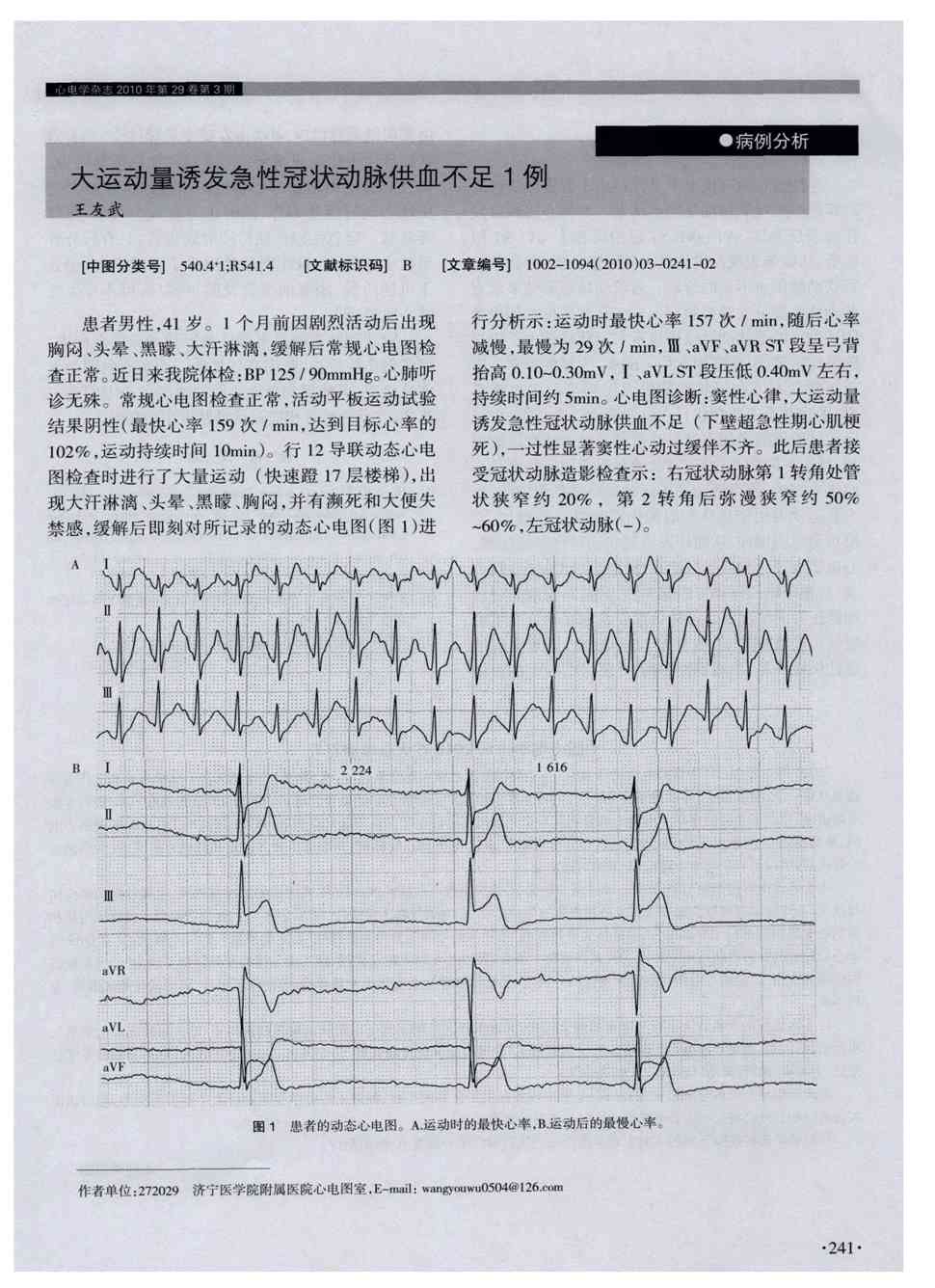 常规心电图检查正常,活动平板运动试验结果阴性(最快心率159次/min