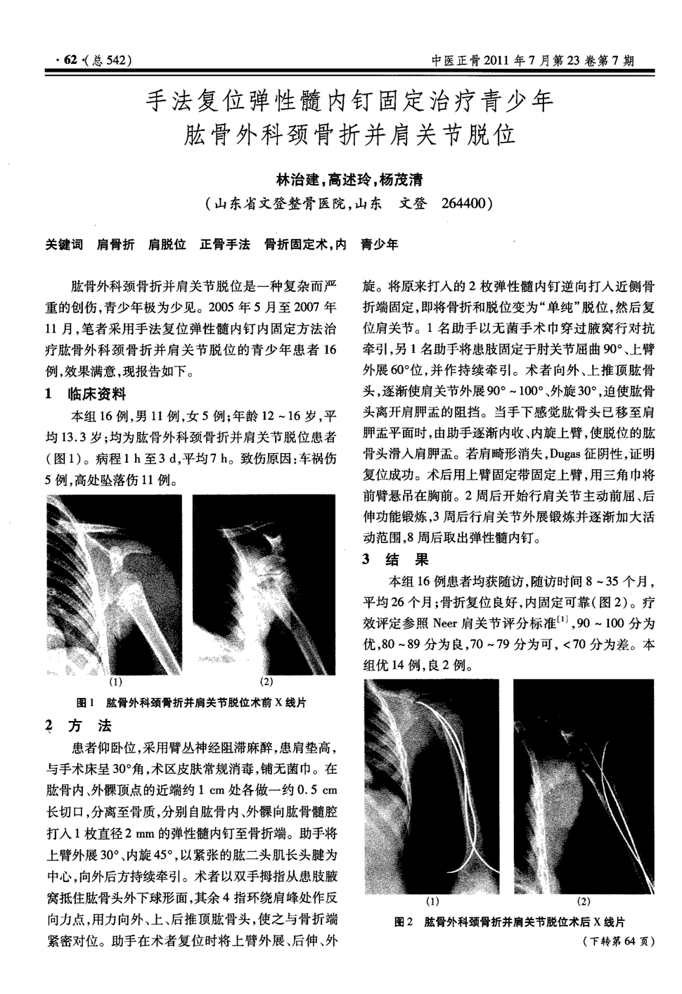 期刊手法复位弹性髓内钉固定治疗青少年肱骨外科颈骨折并肩关节脱位