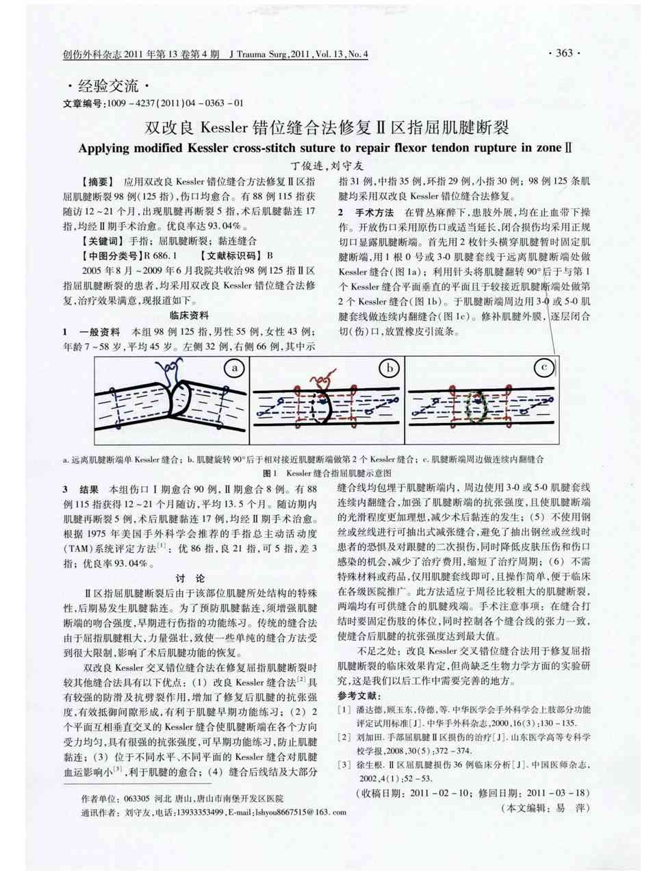 期刊双改良kessler错位缝合法修复Ⅱ区指屈肌腱断裂被引量:4    应用