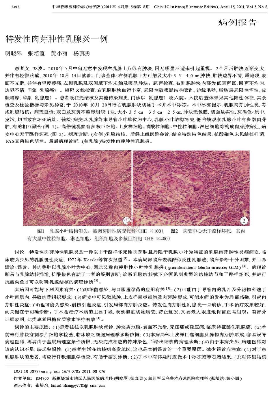 期刊特发性肉芽肿性乳腺炎一例被引量:1      患者女,38岁.