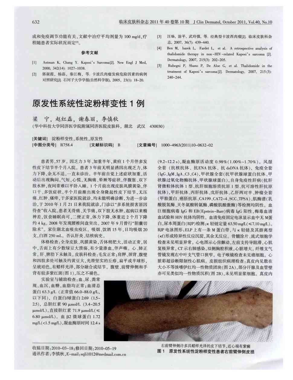 因乏力3年,加重半年,黄疸1个月伴多发性皮下结节半个月入院.